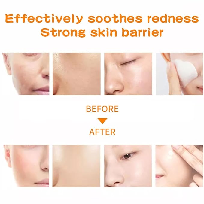 36 Pack Face Masks Skincare Bulk Pack,Hydrating Face Masks Beauty For Sensitive Skin,Sheet Masks For Faces,Facial Masks Sets For Women Skin Care (36-Packs)