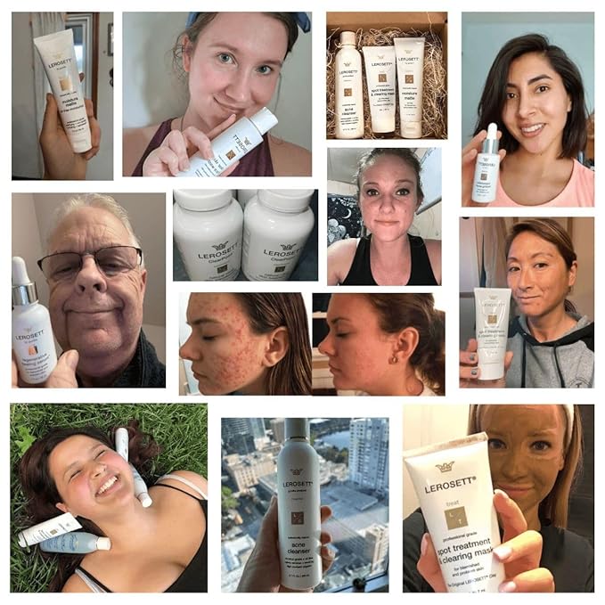 LEROSETT Botanical Acne Cleanser, Foaming Gel Face Wash for Acne Prone, Vegan, Blackheads & Oily Skin 50% Calming Aloe, 2% Salicylic Acid, All Skin Types. Vegan - 6.7oz 60-Day